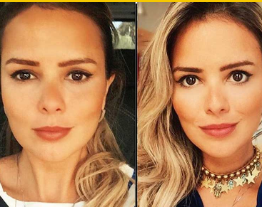 Antes e depois - Definição Facial Feminina